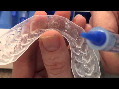 Clareamento dental com moldeiras