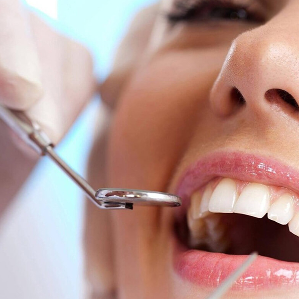 Limpeza Dental, Higienização dos Dentes